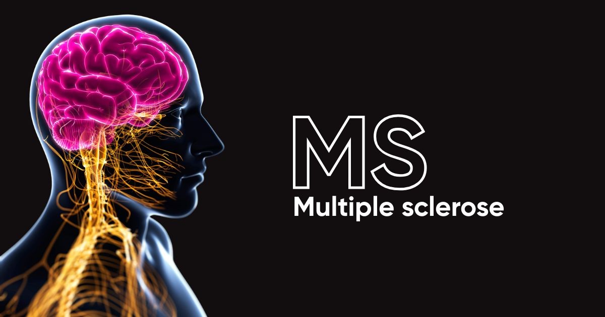 Multiple sclerose: van diagnose tot behandeling en ondersteuning thuis